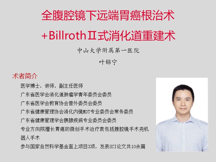 全腹腔镜下远端胃癌根治术+BillrothⅡ式消化道重建术