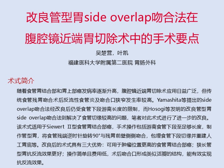 改良管型胃side overlap吻合法在腹腔镜近端胃切除术中的操作要点